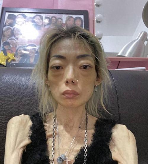 抽烟43年妻子癌晚期