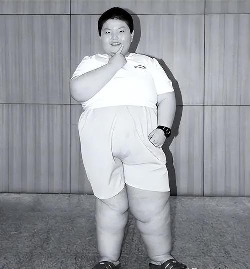 11岁男孩体重224斤